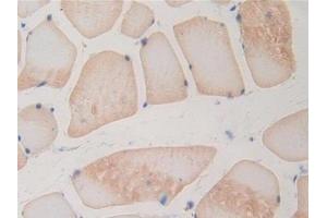 DAB staining on IHC-P; Samples: Rat Skeletal muscle Tissue (BMP15 anticorps  (AA 269-391))