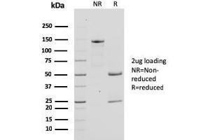 SDS-PAGE Analysis Purified Bcl-x Mouse Monoclonal Antibody (SPM519). (BCL2L1 anticorps  (AA 1-135))