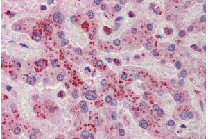 Human Liver: Formalin-Fixed, Paraffin-Embedded (FFPE)