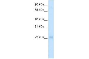 WB Suggested Anti-CSRP3 Antibody   Titration: 2.