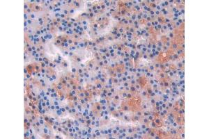IHC-P analysis of adrenal gland tissue, with DAB staining. (IL-17 anticorps  (AA 18-150))