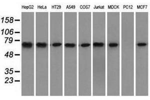 Image no. 4 for anti-Heat Shock 70kDa Protein 1A (HSPA1A) antibody (ABIN1498743)