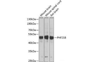 Western blot analysis of extracts of various cell lines using PHF21B Polyclonal Antibody at dilution of 1:1000.