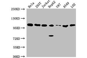 Western Blot Positive WB detected in: Hela whole cell lysate, 293T whole cell lysate, Jurkat whole cell lysate, HepG2 whole cell lysate, U87 whole cell lysate, A549 whole cell lysate, LO2 whole cell lysate All lanes: ADAR antibody at 1:2000 Secondary Goat polyclonal to rabbit IgG at 1/50000 dilution Predicted band size: 137, 134, 132, 141, 104 kDa Observed band size: 104 kDa
