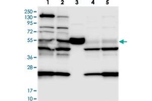 Western blot analysis of Lane 1: RT-4, Lane 2: U-251 MG, Lane 3: Human Plasma, Lane 4: Liver, Lane 5: Tonsil with C11orf84 polyclonal antibody . (C11ORF84 anticorps)