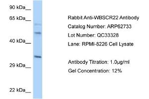 Western Blotting (WB) image for anti-Williams Beuren Syndrome Chromosome Region 22 (WBSCR22) (C-Term) antibody (ABIN2789229) (WBSCR22 anticorps  (C-Term))