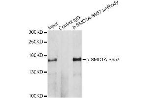 Immunoprecipitation analysis of 200ug extracts of HeLa cells treated by UV using 2. (SMC1A anticorps  (pSer957))