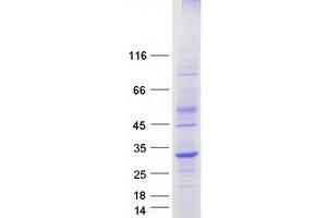 Validation with Western Blot