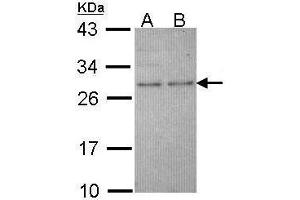 WB Image Sample (30 ug of whole cell lysate) A: Molt-4 , B: Raji 12% SDS PAGE antibody diluted at 1:1000 (HPRT1 anticorps)