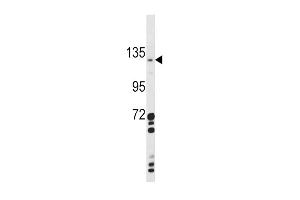 Western blot analysis of CLEC16A Antibody (Center) (ABIN390971 and ABIN2841151) in  cell line lysates (35 μg/lane). (CLEC16A anticorps  (AA 365-391))