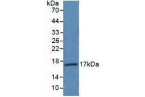 Detection of Recombinant VEGF145, Human using Polyclonal Antibody to Vascular Endothelial Growth Factor 145 (VEGF145) (VEGF145 (AA 28-147) anticorps)
