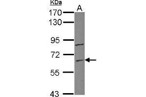 Western Blotting (WB) image for anti-Zinc Finger Protein 282 (ZNF282) (AA 46-303) antibody (ABIN1501833) (ZNF282 anticorps  (AA 46-303))