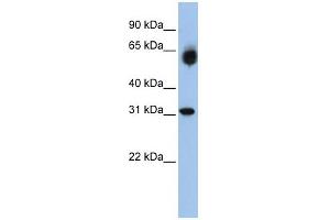 WB Suggested Anti-DHRS2 Antibody Titration:  0. (DHRS2 anticorps  (Middle Region))