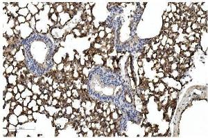 IHC analysis of Caveolin-2/CAV2 using anti Caveolin-2/CAV2 antibody (ABIN7601170). (Caveolin 2 anticorps  (AA 3-162))
