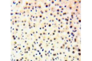 IHC-P analysis of Liver tissue, with DAB staining. (GTF2H1 anticorps  (AA 84-335))