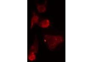 ABIN6275531 staining  HepG2 cells by IF/ICC. (NEK7 anticorps  (Internal Region))