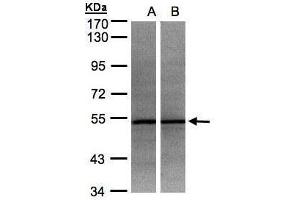 WB Image Sample(30 ug whole cell lysate) A:HeLa S3, B:MOLT4 , 7. (ADPGK anticorps)