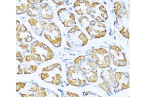 Immunohistochemistry of paraffin-embedded Human stomach using NDUFA5 Polyclonal Antibody at dilution of 1:100 (40x lens). (NDUFA5 anticorps)