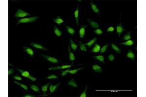 Immunofluorescence of purified MaxPab antibody to IL17C on HeLa cell. (IL17C anticorps  (AA 1-197))