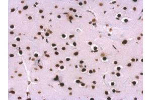 IHC-P Image SNRPA antibody detects SNRPA protein at nucleus on rat fore brain by immunohistochemical analysis.