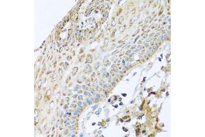 Immunohistochemistry of paraffin-embedded human esophagus using NDUFA2 antibody. (NDUFA2 anticorps)