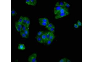 Immunofluorescence staining of HepG2 cells with ABIN7160273 at 1:166, counter-stained with DAPI. (Mu Opioid Receptor 1 anticorps  (AA 1-68))
