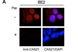 Immunofluorescence results of Endogenous CASZ1.