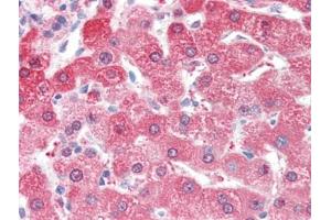Human Liver (formalin-fixed, paraffin-embedded) stained with ALDH2followed by biotinylated goat anti-rabbit IgG secondary antibody, alkaline phosphatase-streptavidin and chromogen. (ALDH2 anticorps  (N-Term))