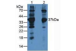 Western blot analysis of (1) Rat Brain Tissue and (2) Human Jurkat Cells. (LDHB anticorps  (AA 1-334))