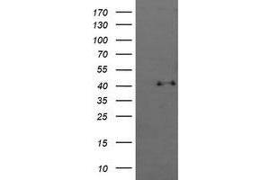 Image no. 1 for anti-Mitogen-Activated Protein Kinase 13 (MAPK13) antibody (ABIN1499955)