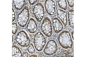 IHC analysis of hnRNP L/HNRNPL using anti-hnRNP L/HNRNPL antibody (ABIN7600130). (HNRNPL anticorps  (AA 152-569))