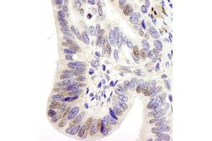 Immunohistochemistry (IHC) image for anti-Ubiquitin Specific Peptidase 28 (USP28) (AA 50-100) antibody (ABIN7448853) (USP28 anticorps  (AA 50-100))