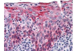 Immunohistochemical analysis of paraffin-embedded human Tonsil tissues using KRT15 mouse mAb