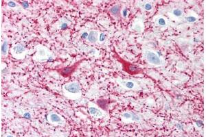 Human Brain, Cortex (formalin-fixed, paraffin-embedded) stained with MAP2 antibody ABIN239819 at 10 ug/ml followed by biotinylated anti-mouse IgG secondary antibody ABIN481714, alkaline phosphatase-streptavidin and chromogen. (MAP2 anticorps)