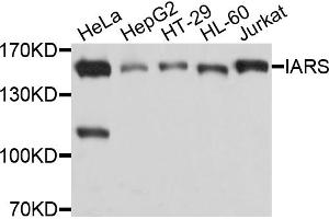 Western blot analysis of extracts of various cell lines, using IARS antibody. (IARS anticorps)