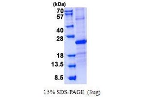 Image no. 1 for Sclerostin Domain Containing 1 (SOSTDC1) protein (His tag) (ABIN1098746) (SOSTDC1 Protein (His tag))