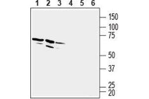 Western blot analysis of rat brain membranes (lanes 1 and 4), mouse brain membranes (lanes 2 and 5) and rat spleen membranes (lanes 3 and 6): - 1-3.