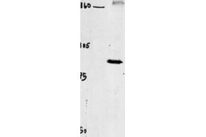 Western Blotting (WB) image for anti-Chloride Channel 4 (CLCN4) antibody (ABIN3002620) (CLCN4 anticorps)