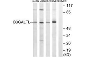 Western blot analysis of extracts from HuvEc/MCF-7/Jurkat/HepG2 cells, using B3GALTL Antibody. (B3GALTL anticorps  (AA 449-498))