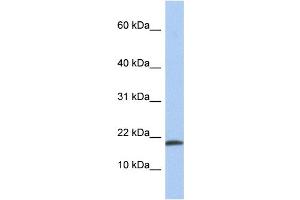 WB Suggested Anti-IL1A Antibody Titration: 0. (IL1A anticorps  (N-Term))
