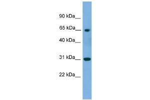 WB Suggested Anti-PNKP Antibody Titration: 0. (PNKP anticorps  (Middle Region))
