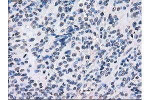 Image no. 10 for anti-Budding Uninhibited By Benzimidazoles 1 Homolog beta (Yeast) (BUB1B) antibody (ABIN1496996) (BUB1B anticorps)