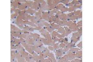 Used in DAB staining on fromalin fixed paraffin- embedded heart tissue (BNIP3 anticorps  (AA 3-134))