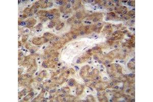 CXCL12 antibody immunohistochemistry analysis in formalin fixed and paraffin embedded human liver tissue.