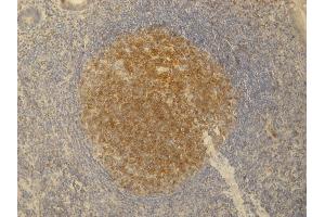 Immunohistochemistry staining (paraffin sections) of PAG/Cbp in germinal center of lymphatic follicle and in dispersed T cells in appendix tissue by monoclonal antibody.