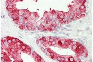 Human Prostate: Formalin-Fixed, Paraffin-Embedded (FFPE) (Tachykinin 3 anticorps  (AA 54-83))