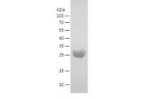 Western Blotting (WB) image for Uridine-Cytidine Kinase 2 (UCK2) (AA 2-261) protein (His tag) (ABIN7125663)