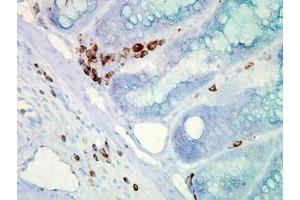 Image no. 2 for anti-Heat Shock Protein 70 (HSP70) (AA 436-503) antibody (ABIN466875) (HSP70 anticorps  (AA 436-503))