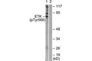 Western blot analysis of extracts from HeLa cells treated with Serum 20% 15', using ETK (Phospho-Tyr566) Antibody. (BMX anticorps  (pTyr566))