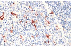Immunohistochemistry of paraffin-embedded Human tonsil using CD68 Polyclonal Antibody at dilution of 1:100 (40x lens). (CD68 anticorps)